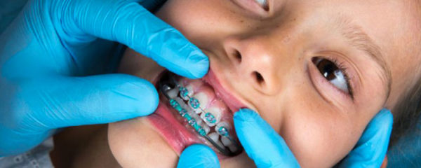 orthodontiste